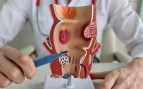Cómo lograr una recuperación con menos dolor y más rápida frente a las hemorroides