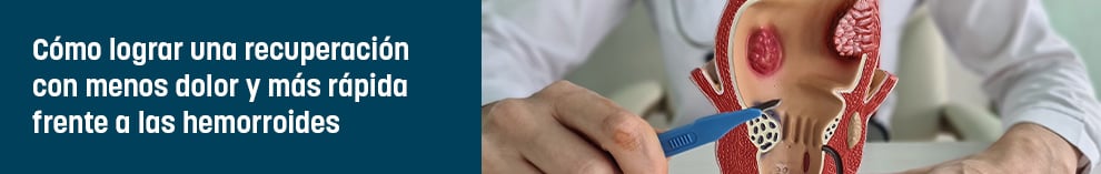 Cómo lograr una recuperación con menos dolor y más rápida frente a las hemorroides