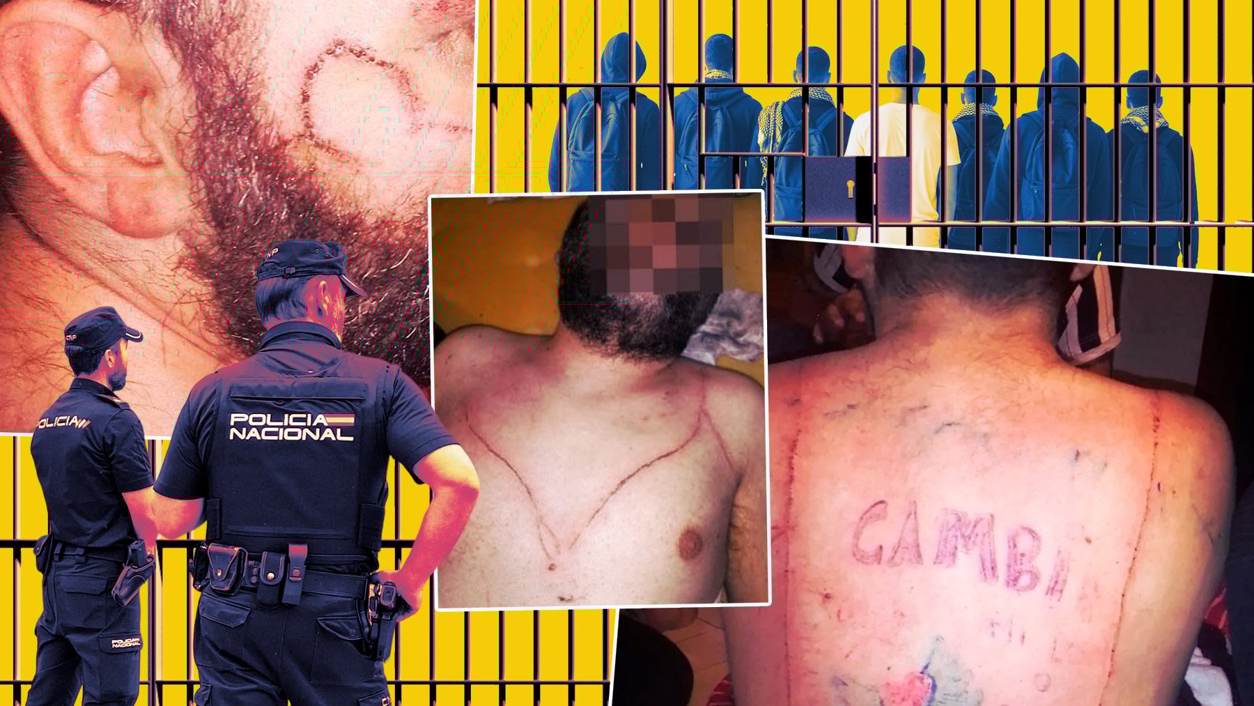 A juicio los 7 jóvenes acusados de torturar y tatuar penes en la cara de un discapacitado en Mallorca