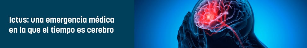 Ictus: una emergencia médica en la que el tiempo es cerebro
