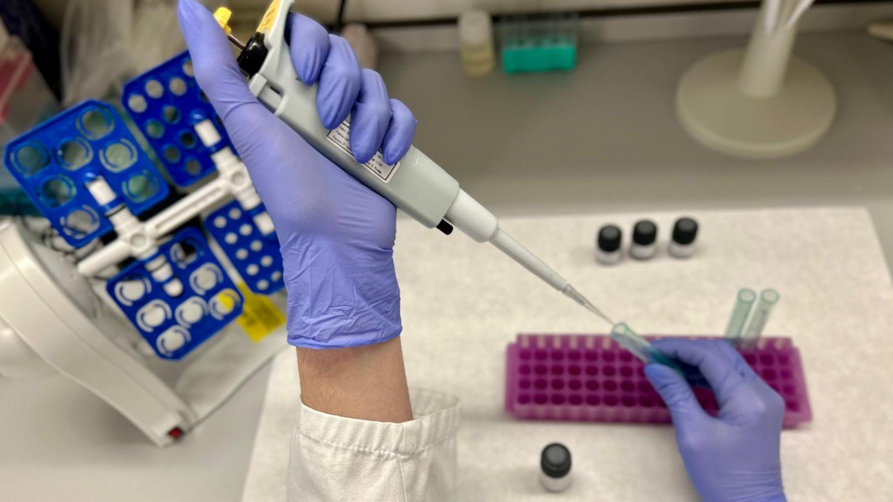 Revolución diagnóstica en la celiaquía: una técnica cambia el abordaje clínico