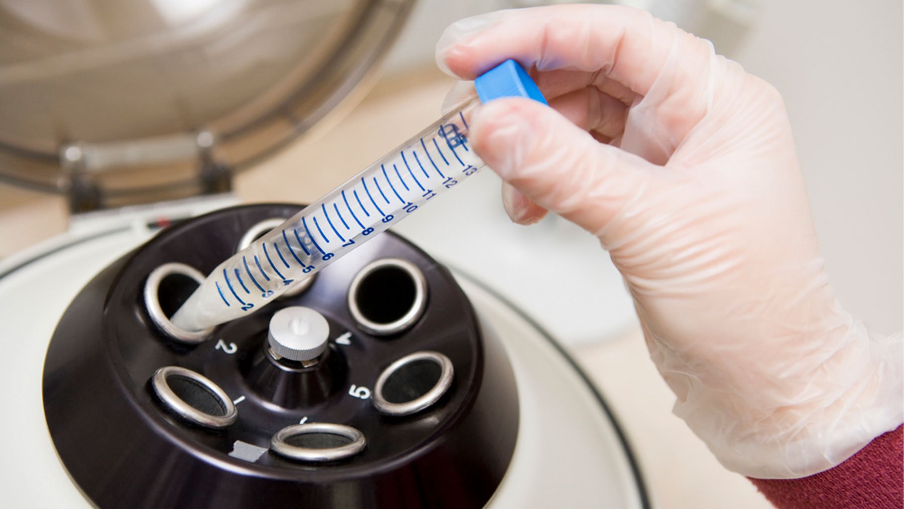 Detectan compuestos químicos de uso cotidiano en el semen que podrían afectar a la salud reproductiva