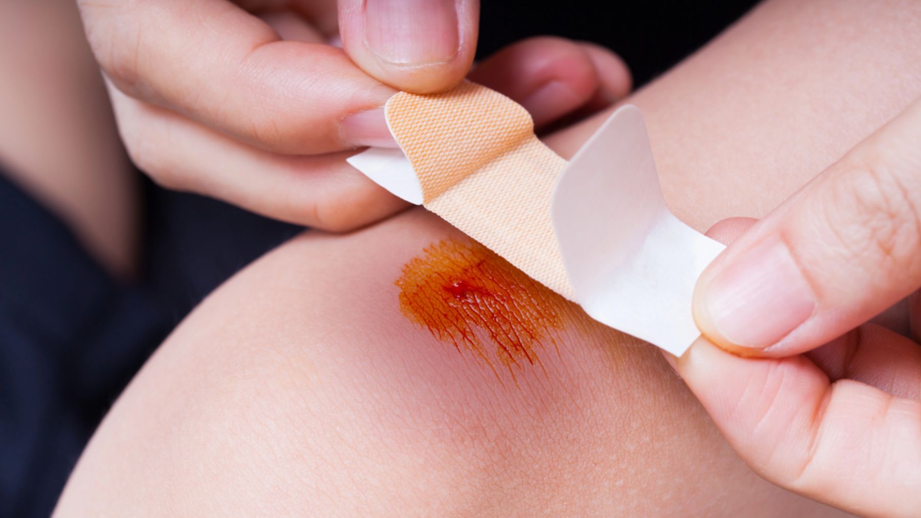 Descubren por qué algunas heridas se niegan a sanar: ésta es la solución que propone un científico