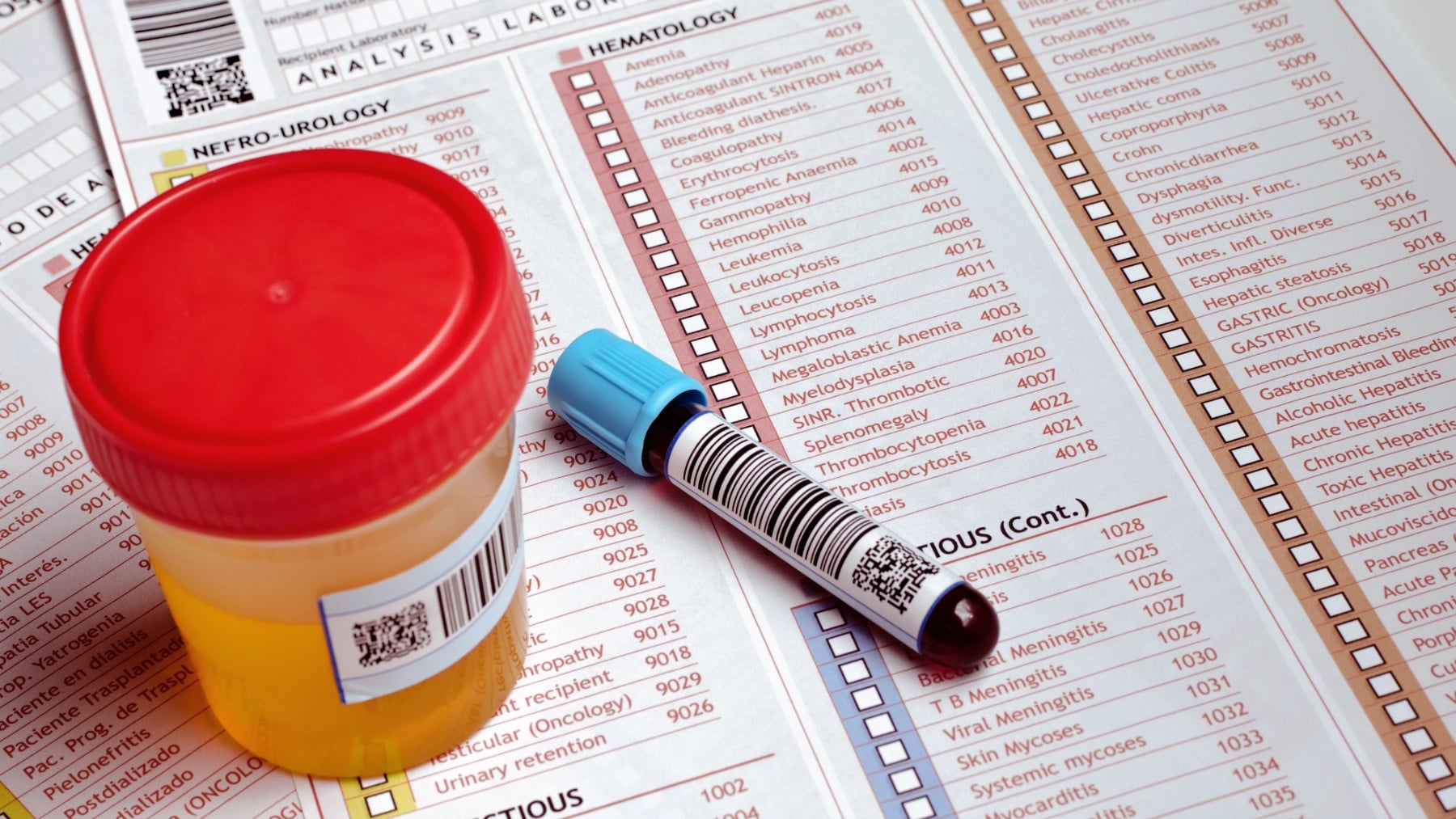 Sangre en la orina: el síntoma que lleva a urgencias y se asocia con una mortalidad del 10% de los pacientes