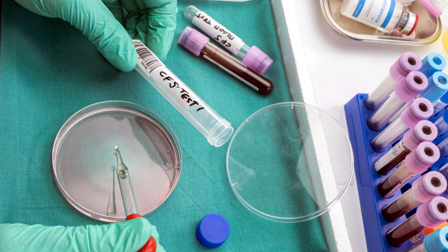 Giro inesperado de la viagra: uno de sus componentes logra mejorar una enfermedad cerebral en niños