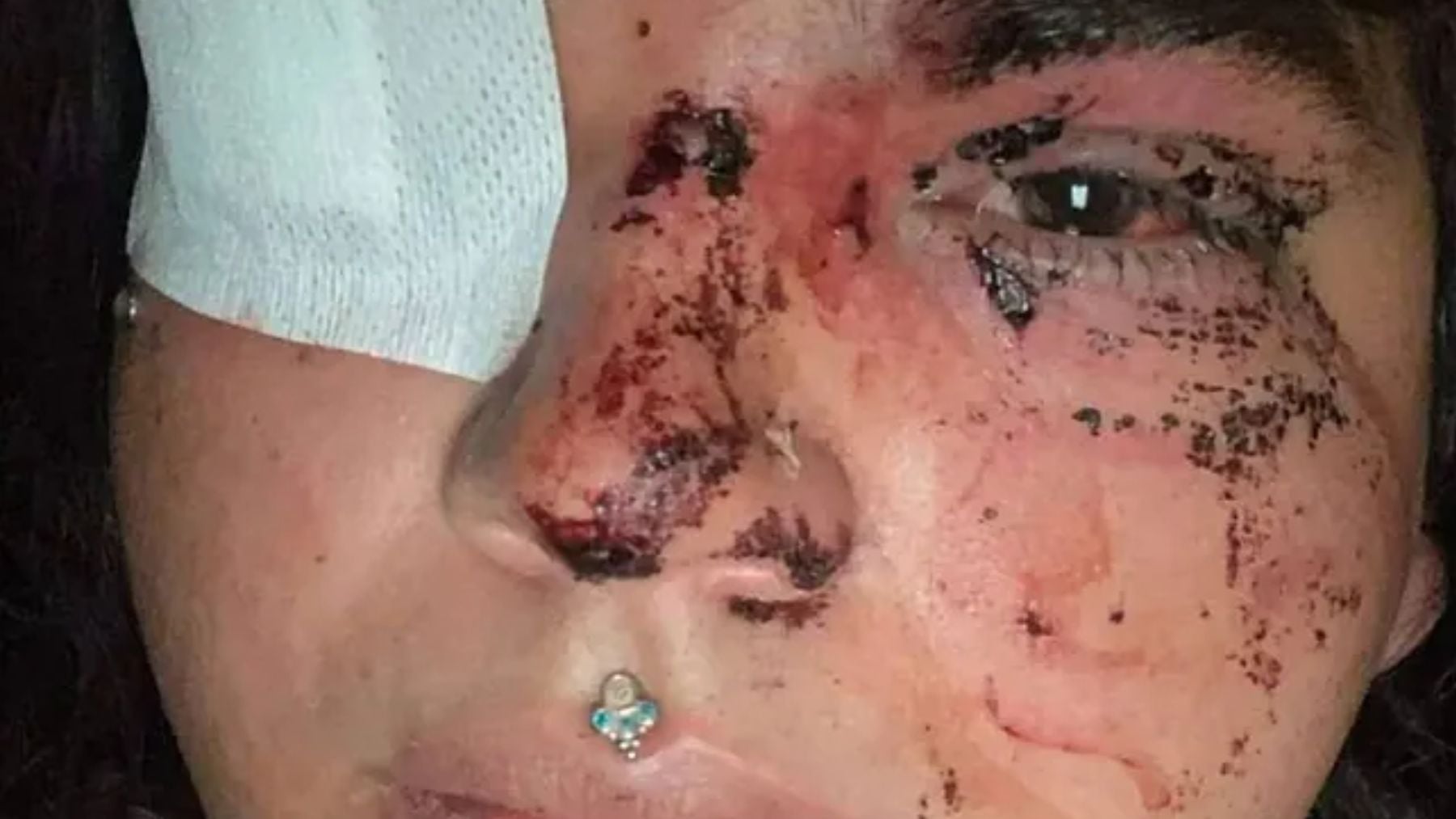 Miss Trans Zamora, víctima de una paliza brutal por ir a un baño de mujeres de un pub de León