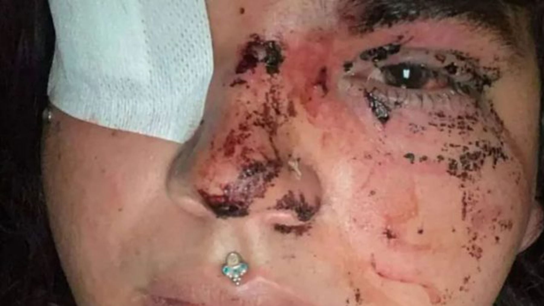 Detenidas cinco mujeres de entre 18 y 24 años por la paliza a una mujer transexual en León