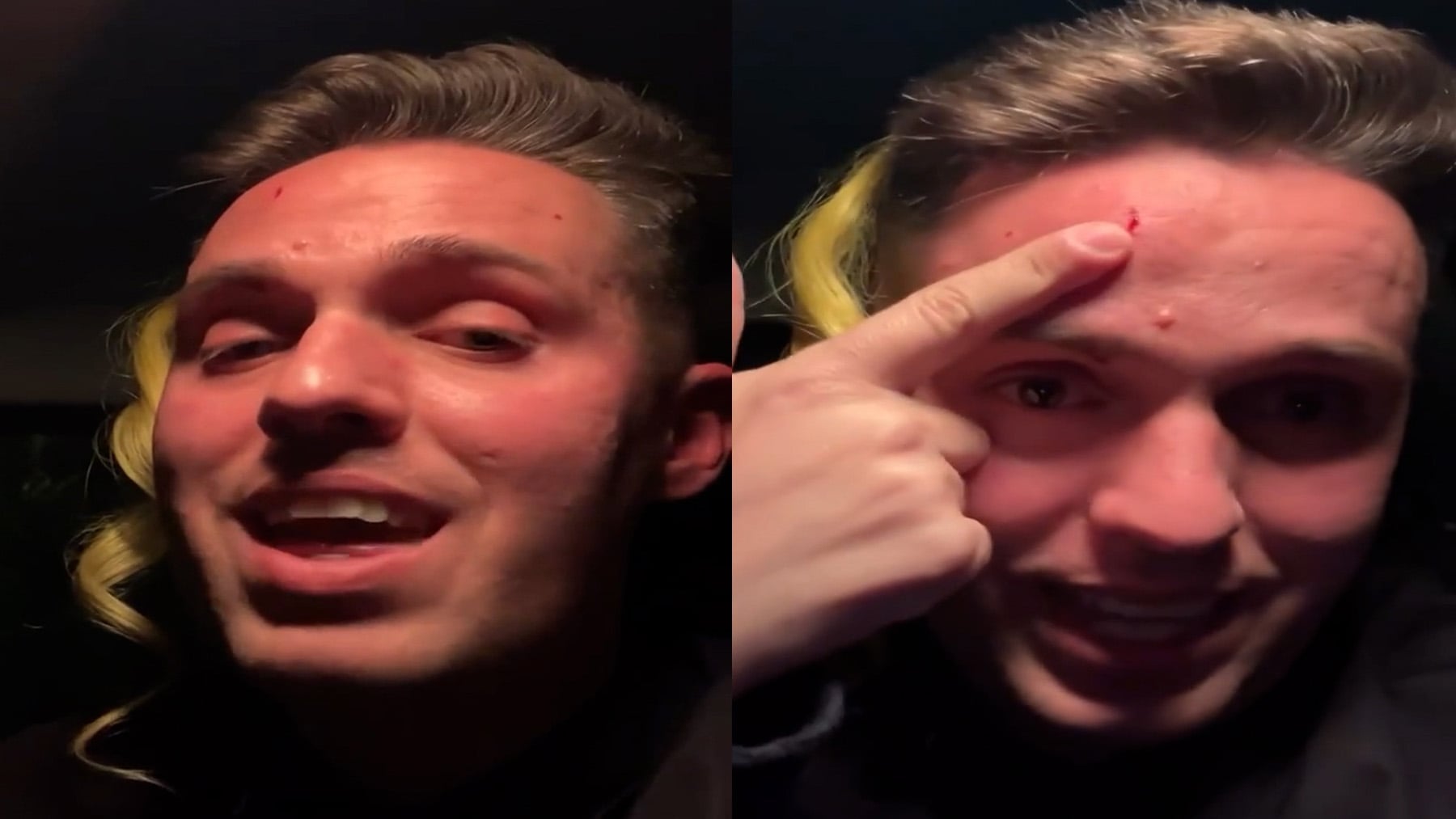 Escalofriante ataque homofóbico sacude la noche mallorquina: Baaldo, un cantante urbano, víctima de una agresión