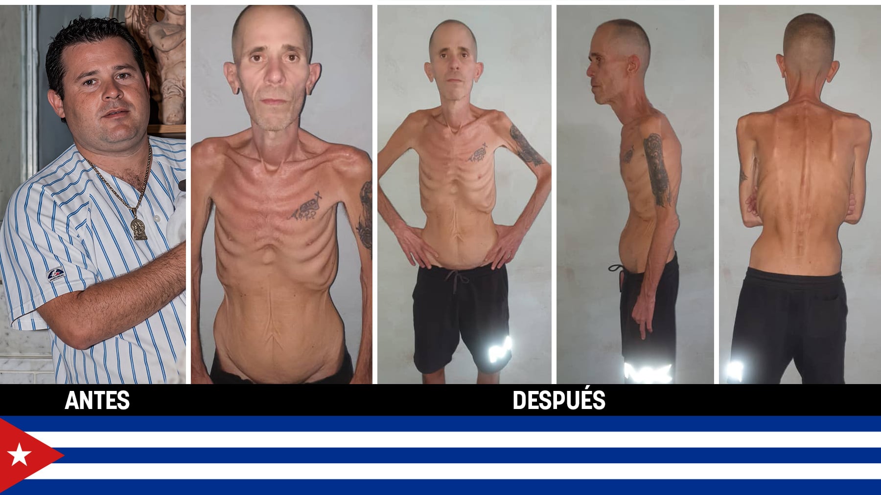 Así tortura Cuba: las terribles imágenes de un preso político tras 4 años en la cárcel de la dictadura