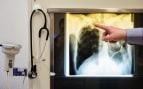 Hito en la medicina espacial: cuatro astronautas sin formación médica consiguen sacar radiografías desde una nave en órbita a la Tierra