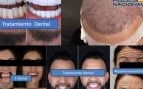 estafadores, pelo, dientes, rejuvenecimiento facial, dni, Policía Nacional, sucesos