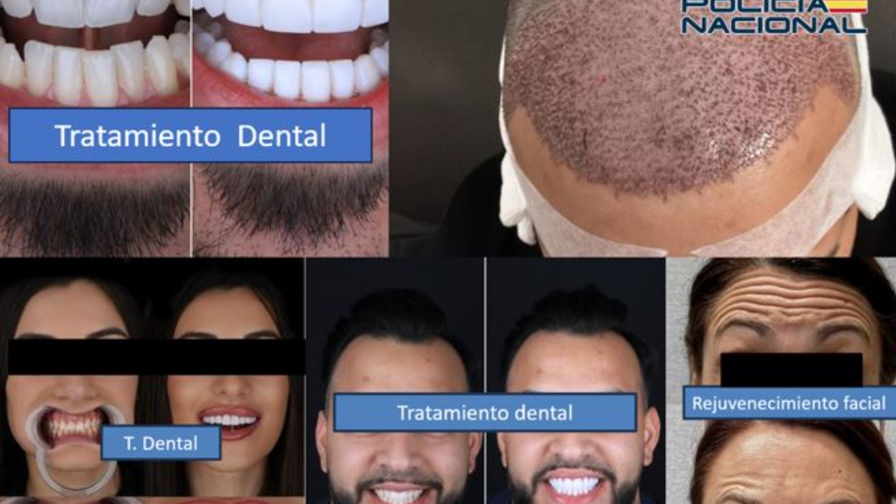 Cae una banda que usaba el dinero estafado a 330 personas en ponerse pelo y dientes nuevos