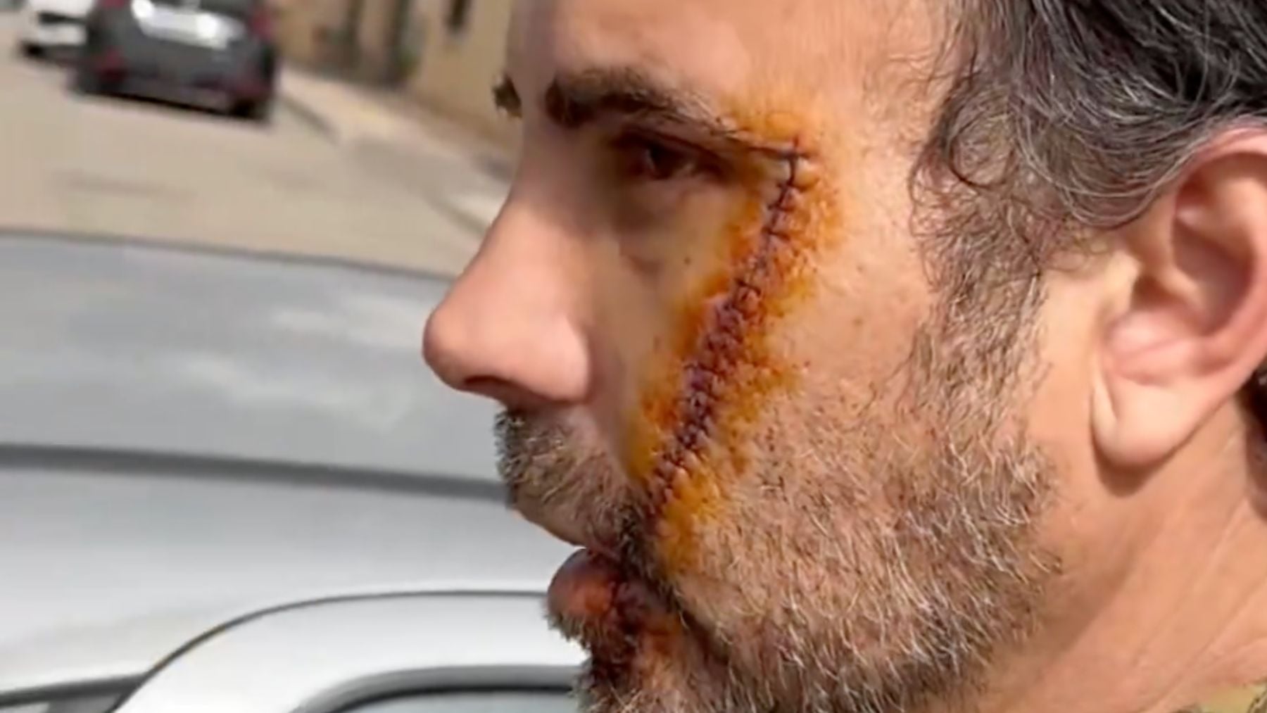 El portugués acuchillado por un marroquí en Málaga advierte: No estáis controlando vuestras fronteras