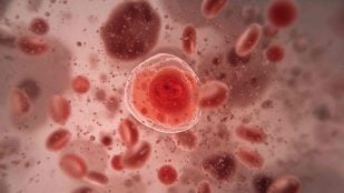 Células y enfermedades