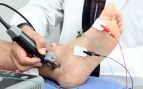 Pie caído: la importancia de la electromiografía para un diagnóstico certero