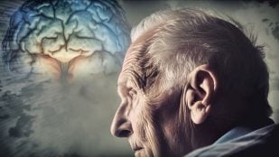 estudio Alzheimer