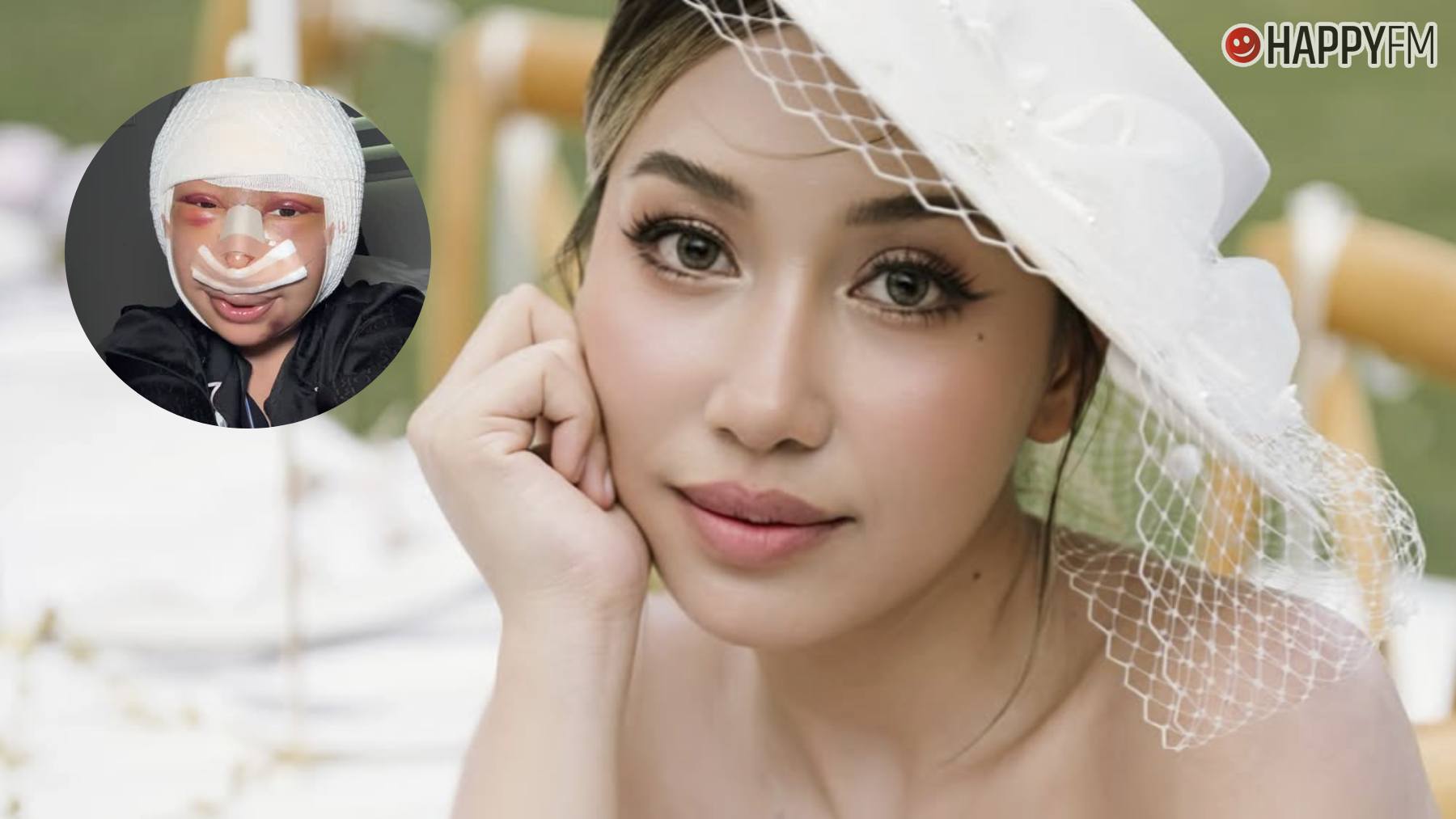 La dura historia de Pugun Wisad, la influencer que se operó la cara por no sentirse más guapa que su novio