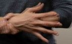 Parkinson