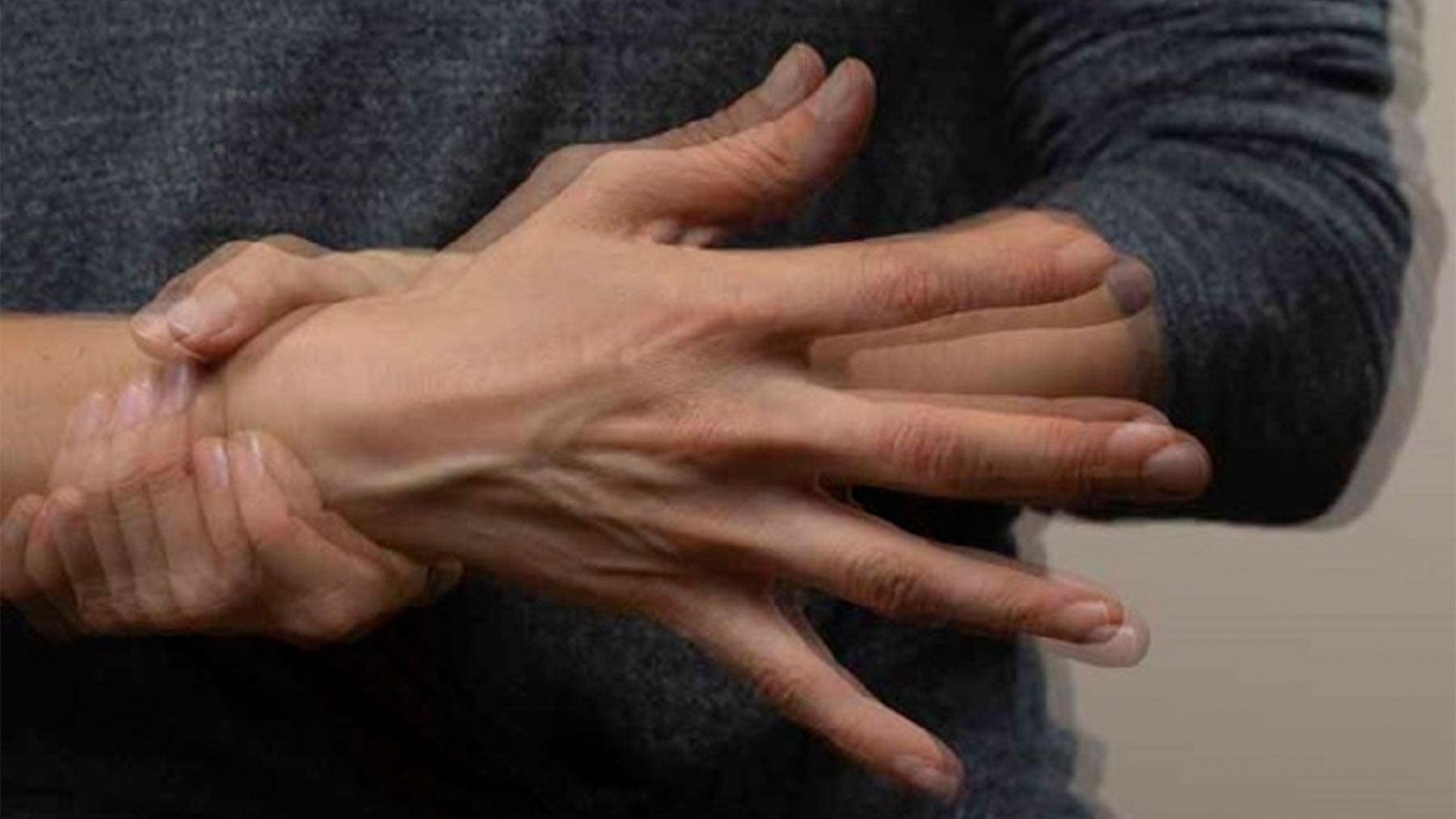 Ser mujer te penaliza si tienes Parkinson: menos acceso y más tarde a las terapias avanzadas