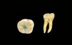 El molar maya estudiado presenta una incrustación de jadeíta en la superficie oclusal. Foto del Museo Popol Vuh.