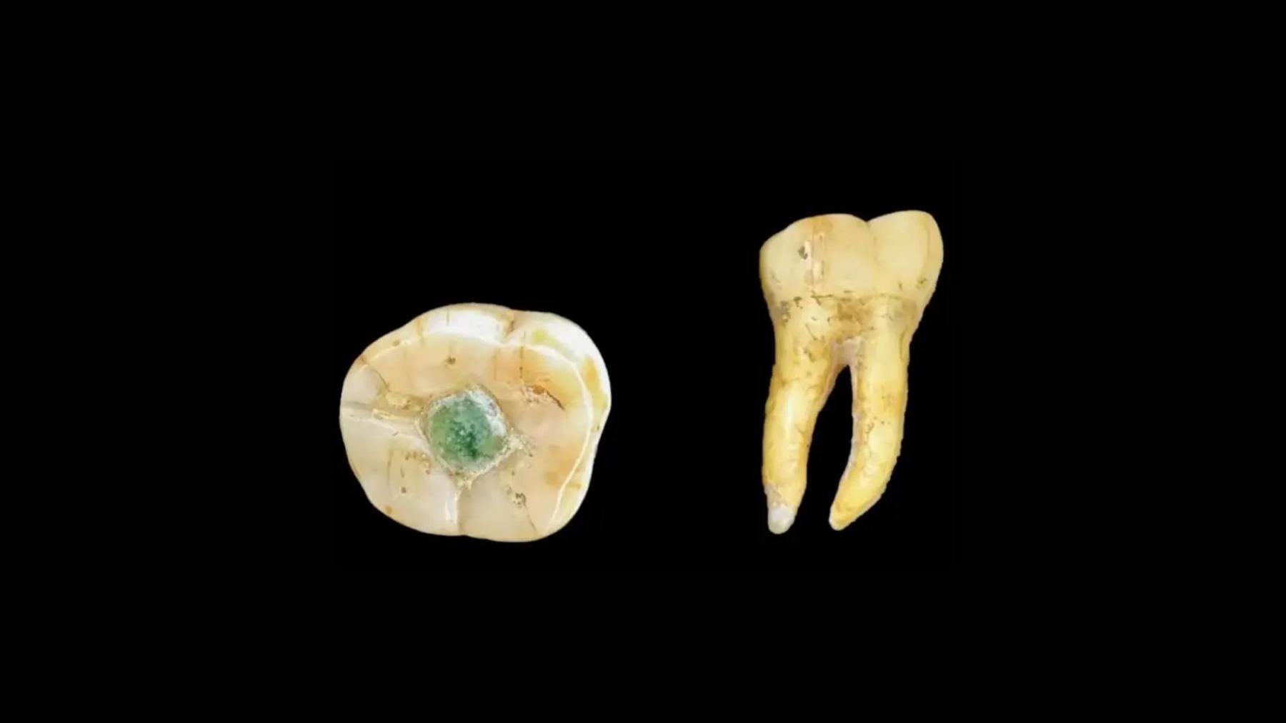 Descubrimiento histórico: encuentran por 1º vez en la historia un empaste dental maya hecho con piedras preciosas