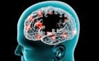 La guerra del milímetro: así es la nueva era contra los tumores cerebrales