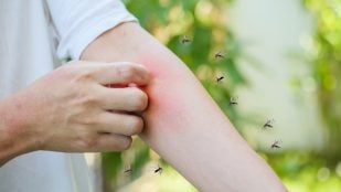 La sangre dulce y los mosquitos