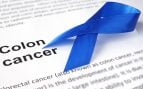 cáncer colon