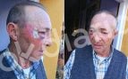 paliza, vecino, Atarfe, Granada, magrebíes, agresión