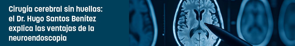 Cirugía cerebral sin huellas: el Dr. Hugo Santos Benítez explica las ventajas de la neuroendoscopia
