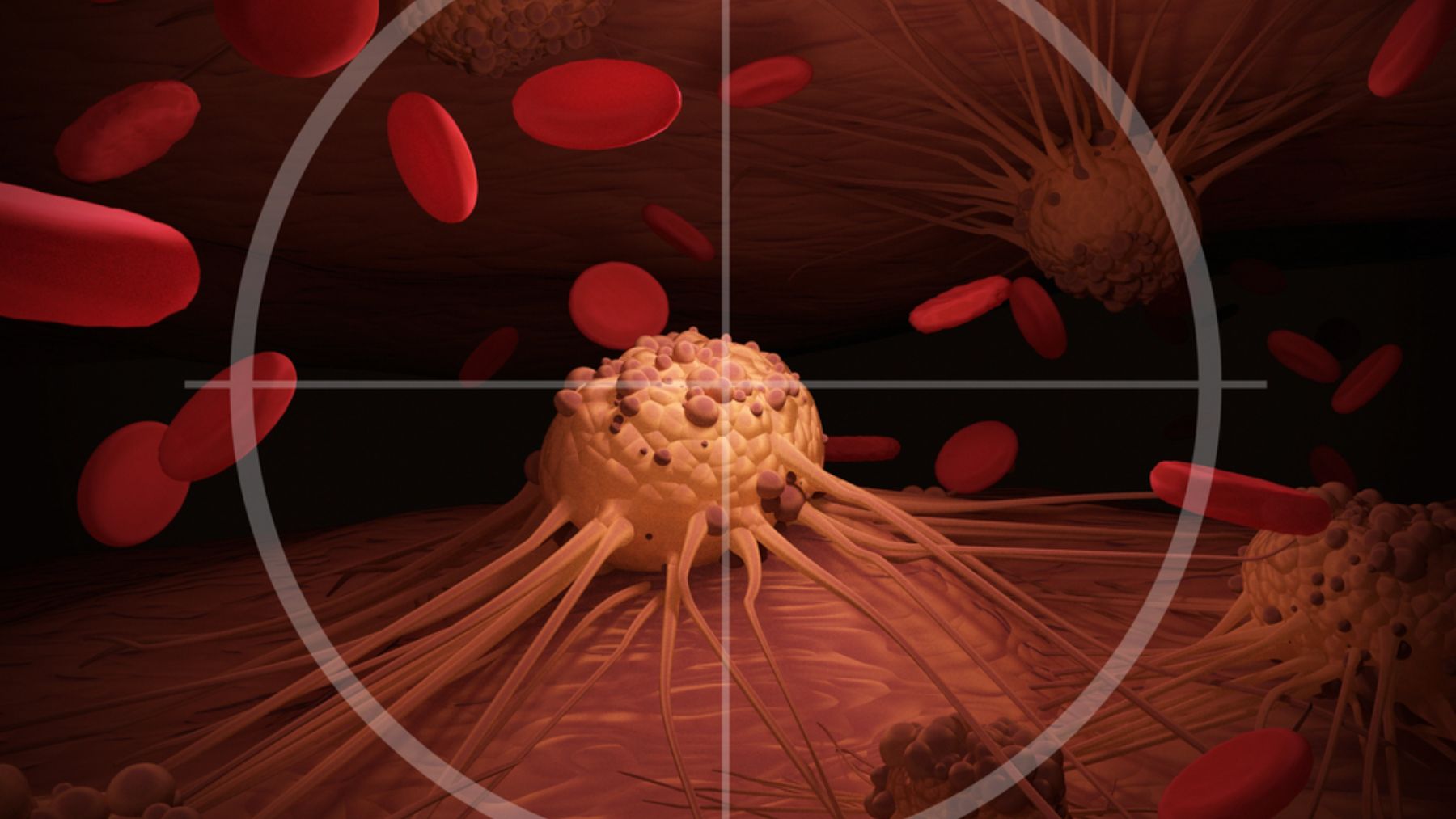La gran cita de los expertos en cáncer destaca el impacto del estilo de vida en el riesgo de enfermedad