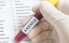 anemia