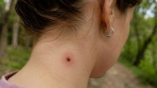 Garrapatas, animales, curiosidades, truco
