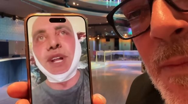 Kiko Matamoros muestra su nuevo rostro en LosKikosTV. (YouTube)