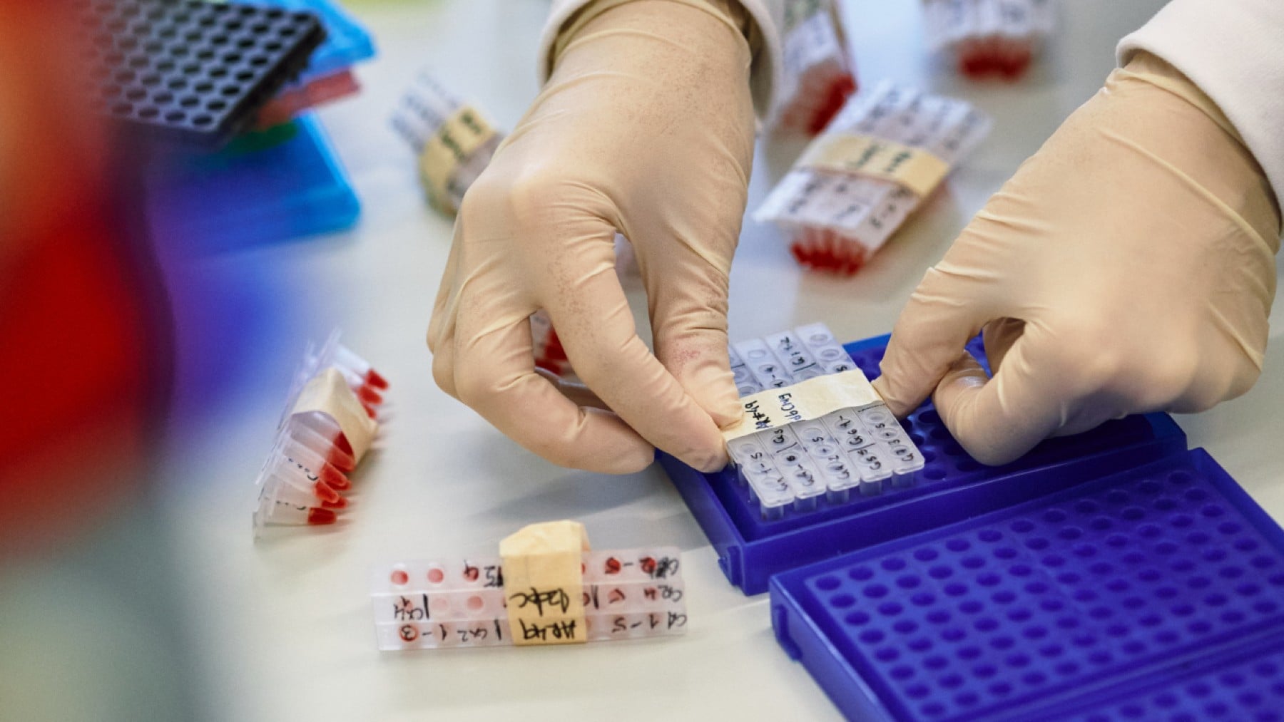 Especialistas en enfermedades raras pediátricas se reúnen en
