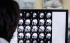 Médica revisando una resonancia magnética. Foto: Freepik
