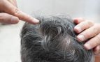 Las canas