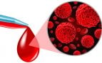 biopsia líquida