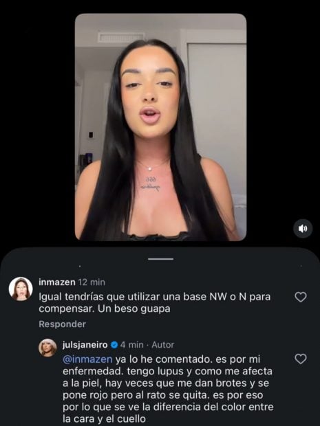 Julia Janeiro desvela que padece lupus. (Foto: Redes Sociales)