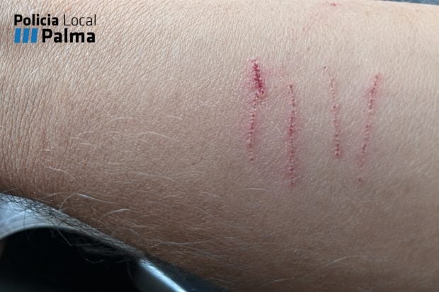 Heridas ataque serpiente