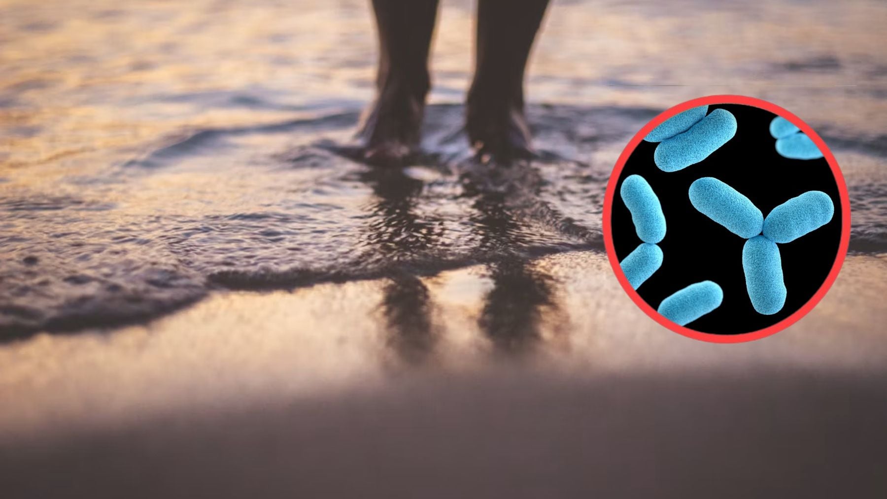 Los científicos alertan de la bacteria carnívora que ya está en las playas españolas: Puede pasar de los calambres y dejarte en coma