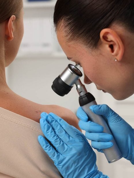 lunares piel verano vigilar dermatologo