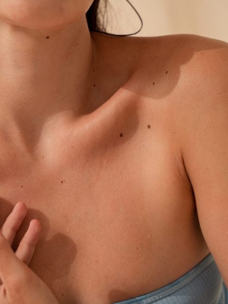 lunares piel verano vigilar dermatologo