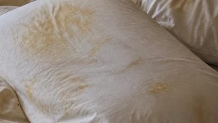 Manchas amarillas en la almohada