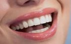 ¿Funcionan los sérums dentales? Expertos analizan el fenómeno viral del blanqueamiento