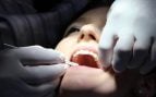Operan a una mujer del tobillo y sale sin dientes del quirófano: ¿qué paso realmente y por qué ocurrió esto?