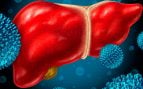 hepatitis C