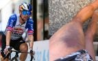 Primoz Roglic muestra su lesión