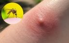 Mosquitos
