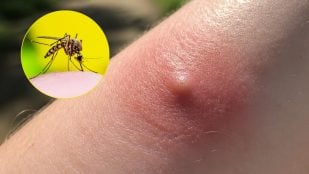 Mosquitos